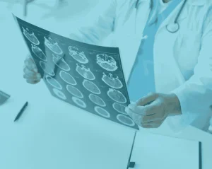 Expertly Crafting a Demand Letter for Traumatic Brain Injury Cases: Trivent’s Approach