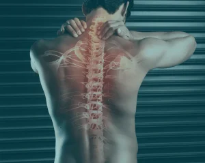 How Trivent Legal Supported Trial Preparation for a Spinal Cord Injury Case Due to Epidural Steroid Injection     